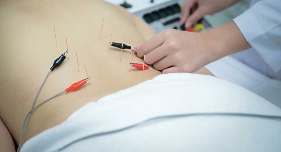 Υγεια - θεραπευτες Τι είναι ο ηλεκτροβελονισμός; 1 Θεραπευτές 7