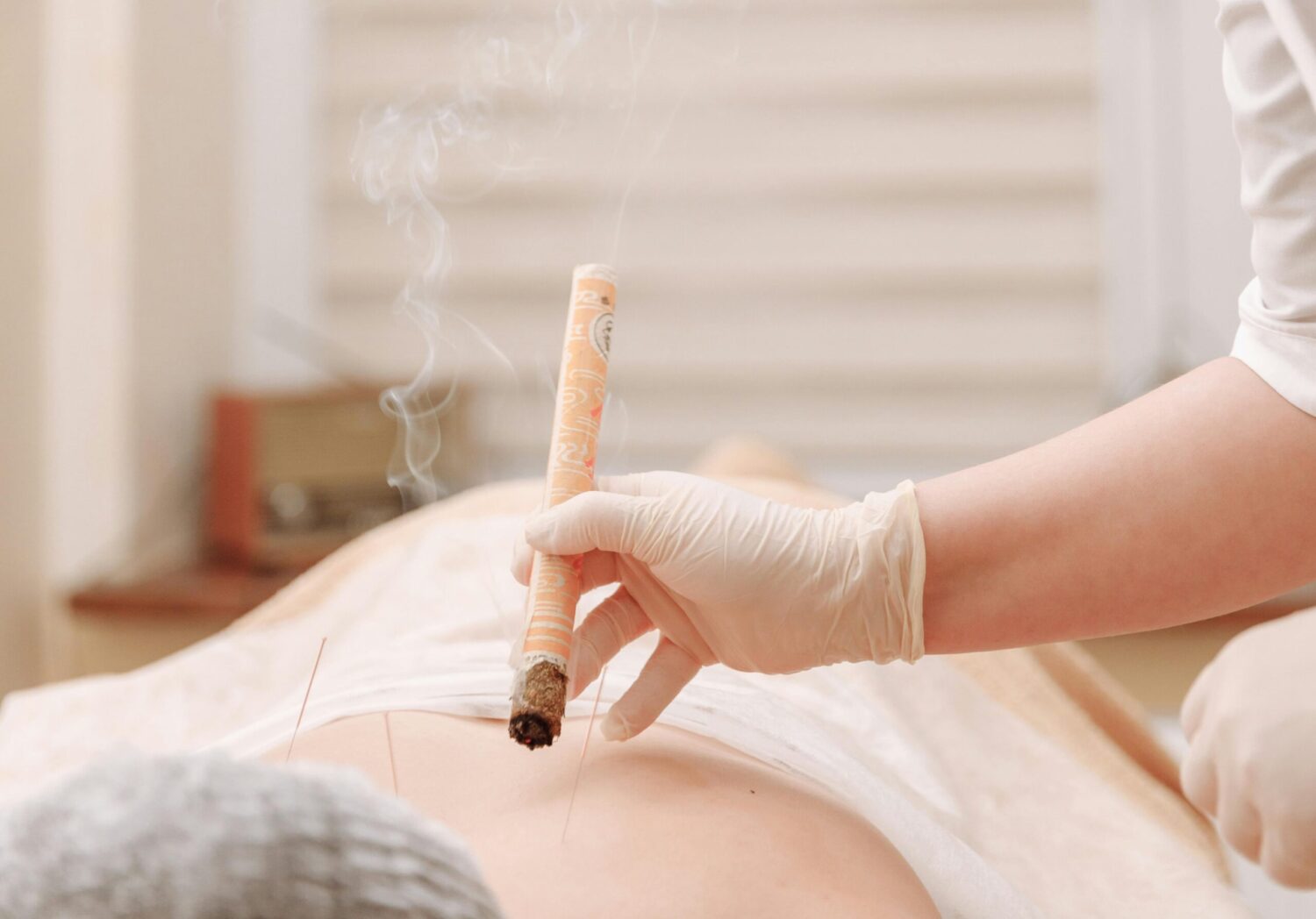 Υγεια - θεραπευτες Τι είναι η θεραπεία με μόξα; 1 Θεραπευτές chinese scaled e1720892769405