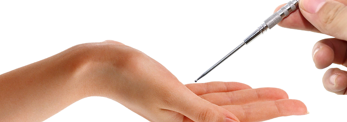 Υγεια - θεραπευτες Τι είναι το su jok; 1 Θεραπευτές screenshot 2024 12 03 172928